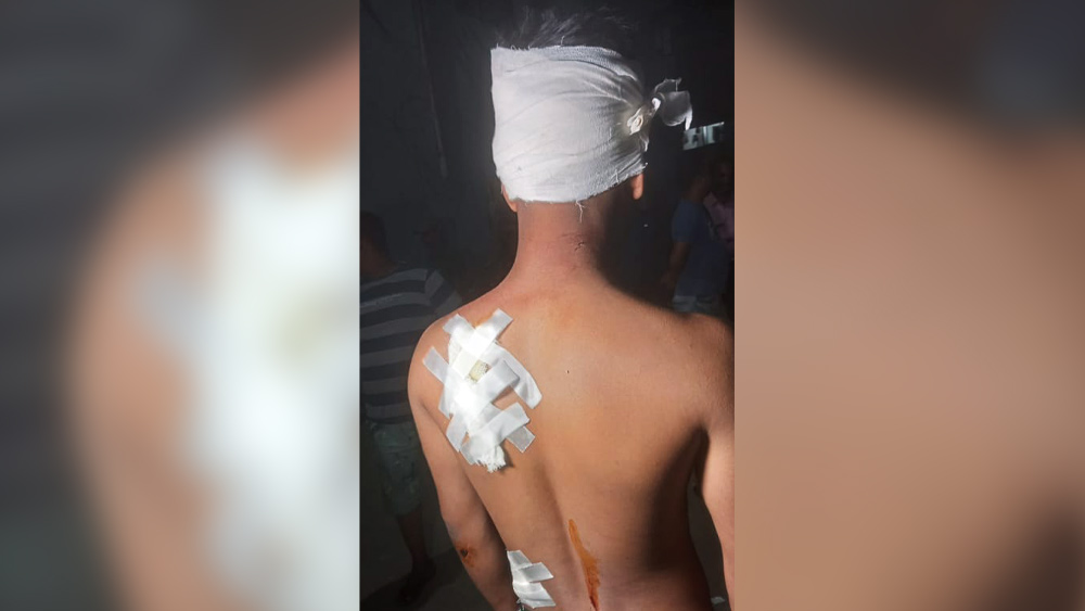 HS Student allegedly attacked by goons as he protests of bursting of crackers in front of his house dgtld