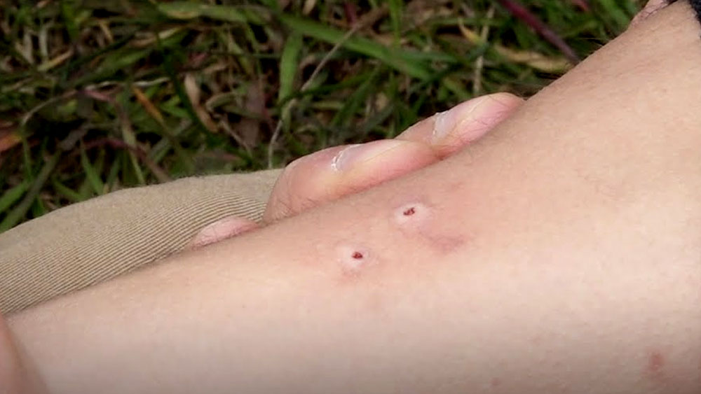 কামড়ের দু’টো দাগ দেখে সন্দেহ জাগে তদন্তকারীদের। সর্পবিশারদদের মতে, কোনও সাপ দু’বার কামড় দিয়ে বিষ নষ্ট করতে চায় না। তা ছাড়া, প্রথম কামড়ের পরেই যন্ত্রণায় উথরার ঘুম ভেঙে যাওয়ার কথা।