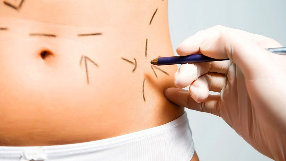 অতঃপর, সোমবারই প্লাস্টিক সার্জারি করানোর সিদ্ধান্ত নেন কন্নড় নায়িকা।