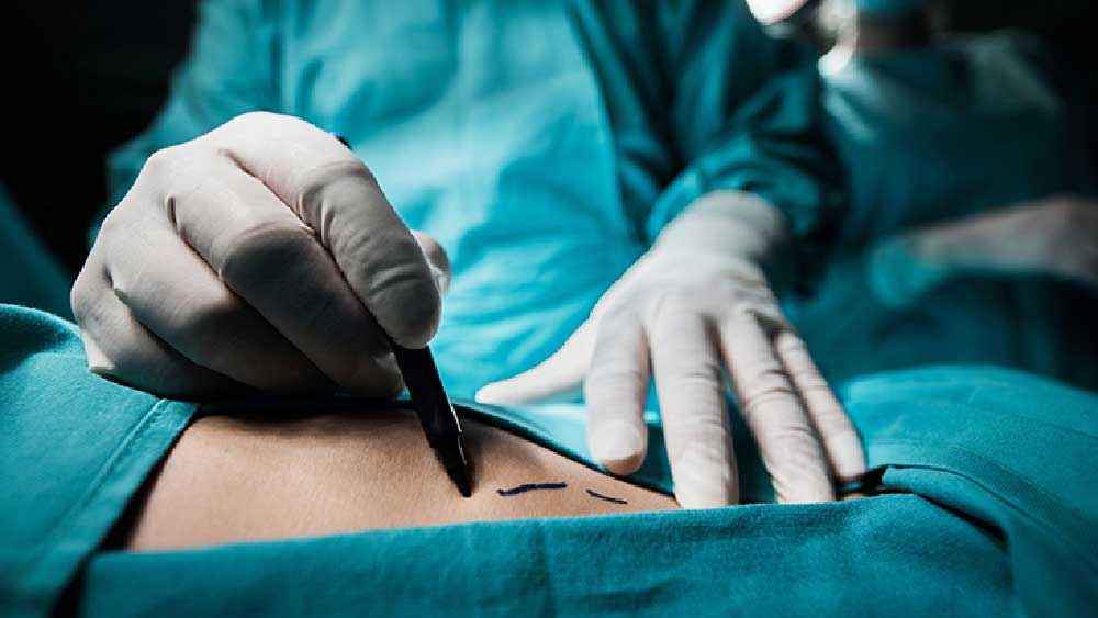 বিনোদন দুনিয়ায় প্লাস্টিক সার্জারি করে নিজেকে বদলে ফেলার প্রচেষ্টা এই প্রথম নয়। 