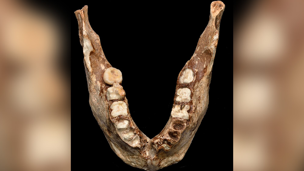 দাঁতের বাইরের অংশের প্রোটিন পরীক্ষা করার পর গবেষকরা জানিয়েছেন, এই দাঁত সম্ভবত সাড়ে তিন থেকে সাড়ে আট বছর বয়সি এক নাবালিকার।