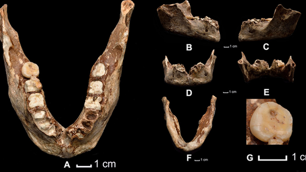 তাপ এবং আর্দ্রতার কারণে দাঁতটির ডিএনএ অনেকাংশেই নষ্ট হয়ে যায়।