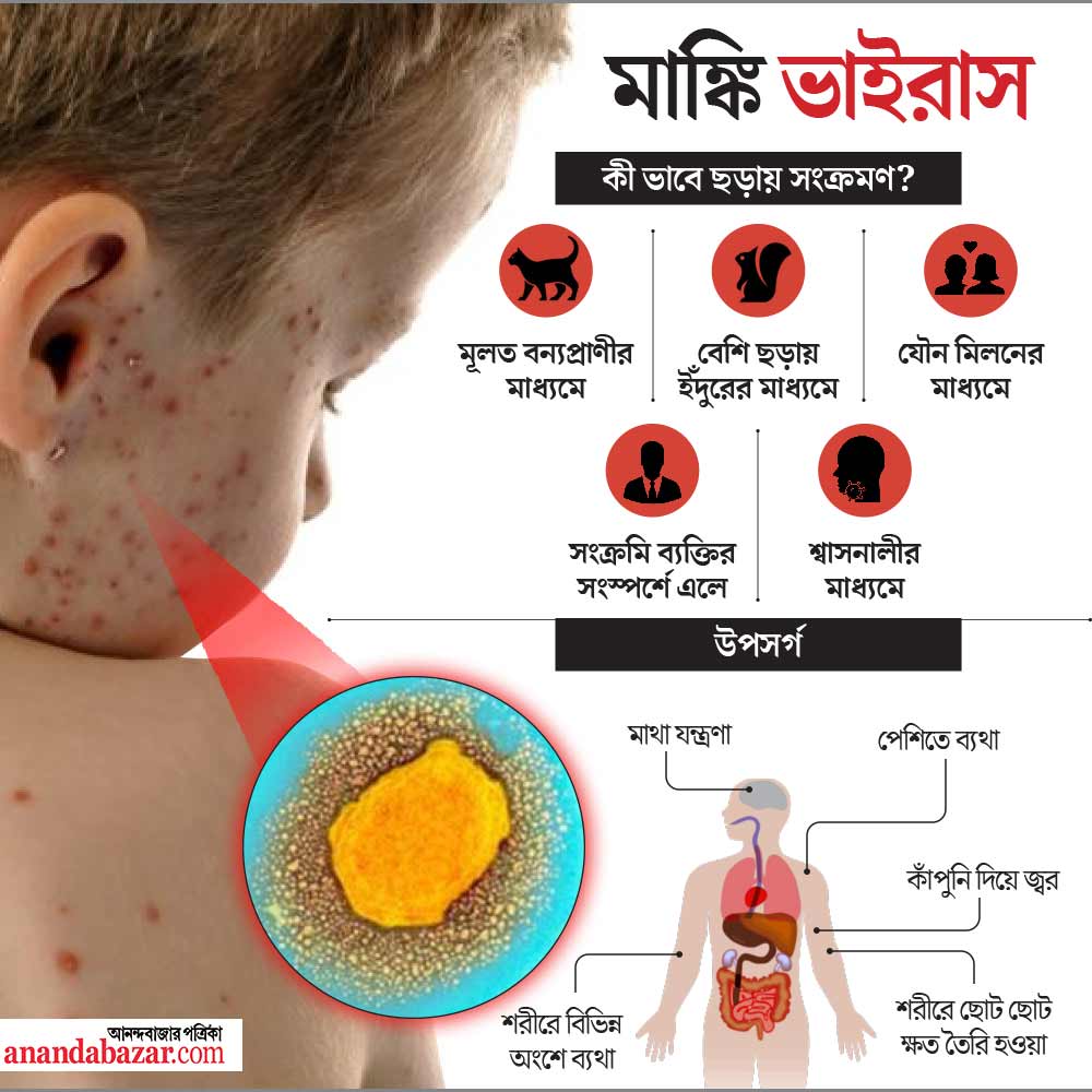 Health What is the difference between monkey pox and chicken pox dgtl
