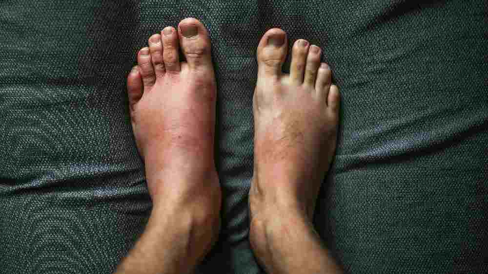 প্রতীকী ছবি।