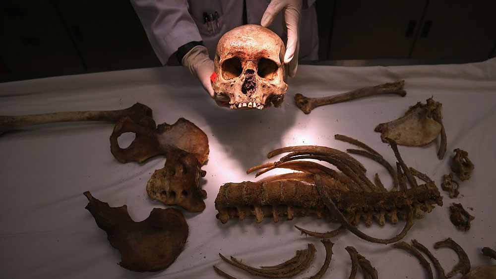 কঙ্কালটির ময়নাতদন্ত করেছিলেন কোচির ওই মেডিক্যাল কলেজের ফরেন্সিক বিশেষজ্ঞ উন্মেষ কেএ। সংবাদমাধ্যমকে তিনি জানিয়েছিলেন, ময়নাতদন্তের পর জানা গিয়েছিল যে সেটি মহিলার কঙ্কাল। 