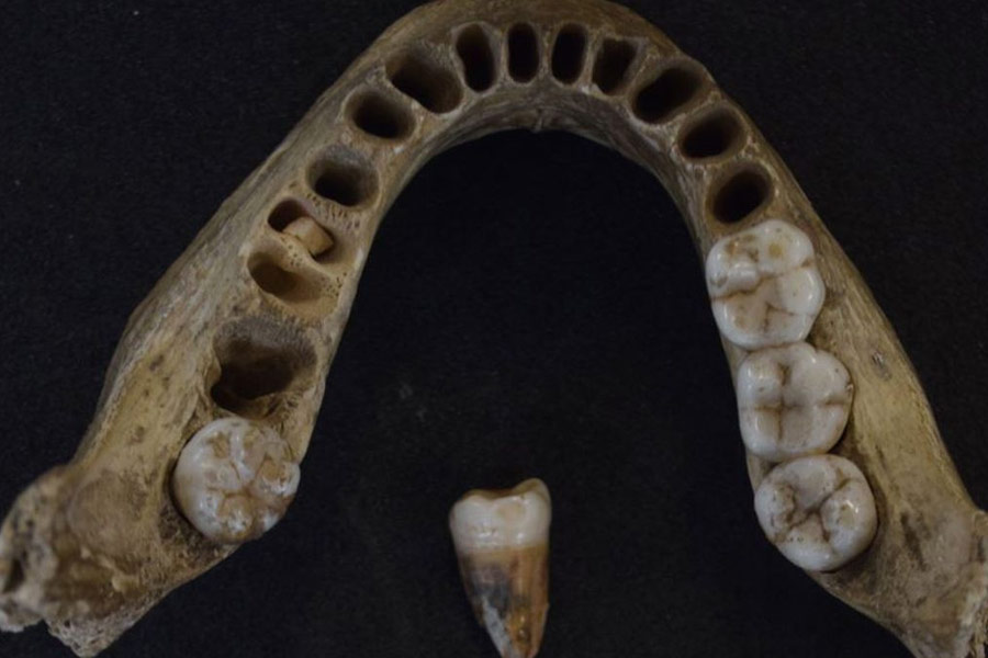 গবেষণায় জানা গিয়েছে, প্রাচীন মানুষের দেহ থেকে চোখ, ঠোঁটের মতো যাবতীয় নরম অংশ পাথর দিয়ে কেটে কেটে বার করে নেওয়া হত। এগুলি অনেক ক্ষেত্রে প্রিয় খাদ্য হিসাবে বিবেচিত হত। এই নরম অঙ্গগুলির জন্য নরখাদকদের আগ্রহ ছিল অপেক্ষাকৃত বেশি, দাবি গবেষণায়।