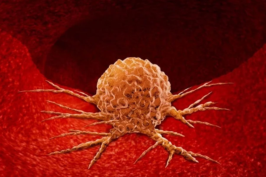 প্রচারের রমরমার কারণে ব্রঙ্কলি খুব শীঘ্রই ‘আমেরিকান মেডিক্যাল অ্যাসোসিয়েশনের (এএমএ)’ দৃষ্টি আকর্ষণ করেন। ব্রঙ্কলির চিকিৎসা পদ্ধতির বিষয়ে জানতে তাঁর ক্লিনিকে গুপ্তচর পাঠায় এএমএ।