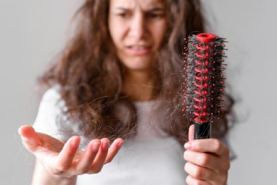 প্রতি দিন ৫০ থেকে ১০০টি করে চুল ঝরে যাওয়া স্বাভাবিক।