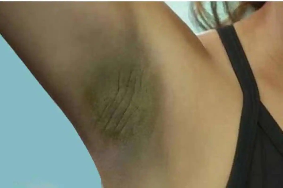 প্রতিদিন হালকা গরম জলে স্নান করতেই হবে। 