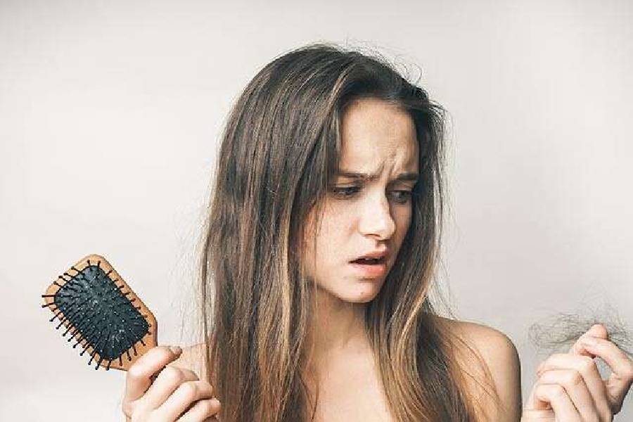 চুল ঝরার মতো সমস্যা দেখা দেয়।