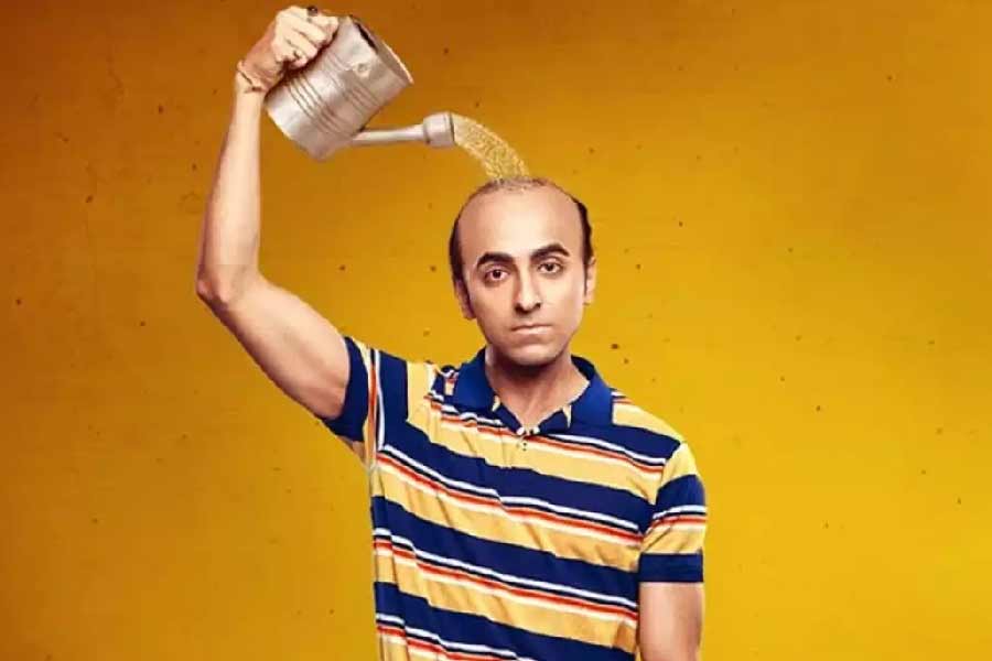 চুলের মতো টাকের যত্ন নেওয়াও কিন্তু জরুরি। 