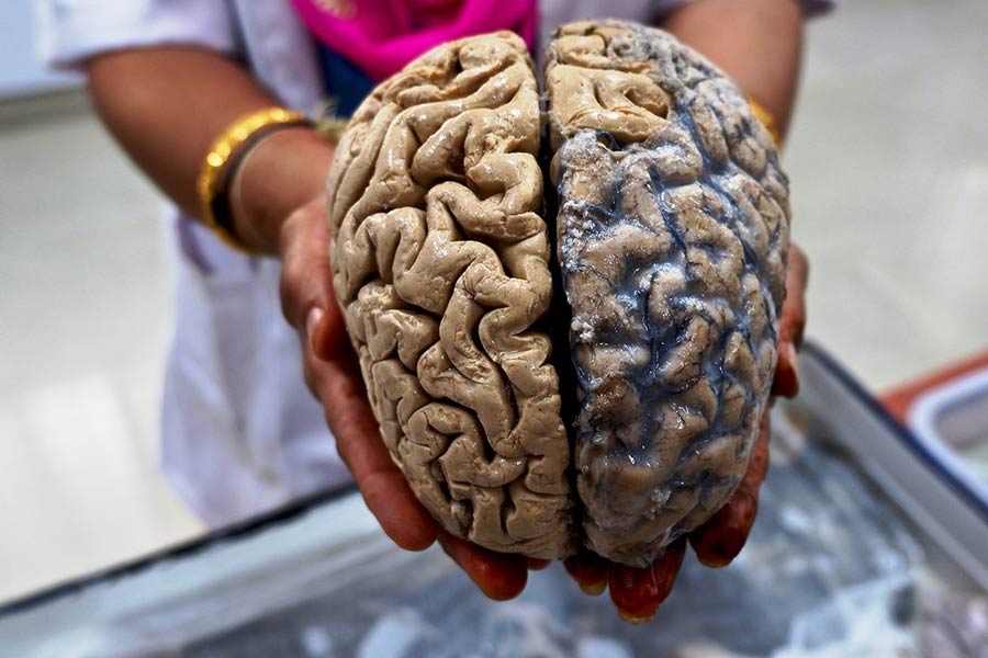 ২০১৮ সালে অর্থাভাবে ওই সংগ্রহটি অন্য একটি বিশ্ববিদ্যালয়ে সরিয়ে নিয়ে যাওয়া হয়েছিল বলে দাবি। সে সময় ওই ইনস্টিটিউটের প্যাথোলজিস্ট মার্টিন ডব্লিউ নিয়েলসন গোটা ব্যবস্থাপনার দায়িত্বে ছিলেন বলে সংবাদমাধ্যমের দাবি। অনেকের কাছেই মার্টিনের পরিচিতি হয়ে যায় ‘ব্রেন কালেক্টর’ নামে।