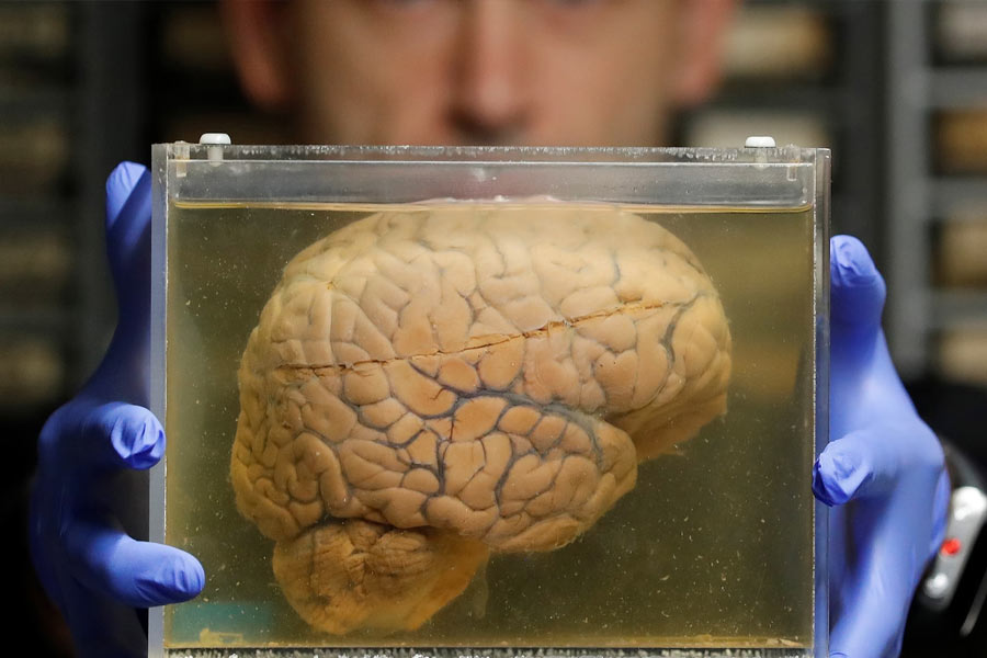 মস্তিষ্কগুলি অন্যত্র সরানোর সময় একটি নতুন পাত্রে সেগুলি ফর্মালডিহাইডে চুবিয়ে নিয়ে যাওয়া হত, যাতে তা অক্ষত থাকে। প্রতিটি পাত্রে গায়ে কালো কালিতে একটি নম্বর লিখে রাখা হত, যাতে ওই মস্তিষ্কগুলির কার, তা বোঝা যায়। এ ভাবেই ওই মস্তিষ্কগুলি কোন কোন রোগীর, তা জানা গিয়েছে। যদিও ১ নম্বর মস্তিষ্কটি কার, সে সম্পর্কে এখনও অন্ধকারে চিকিৎসক মহল।