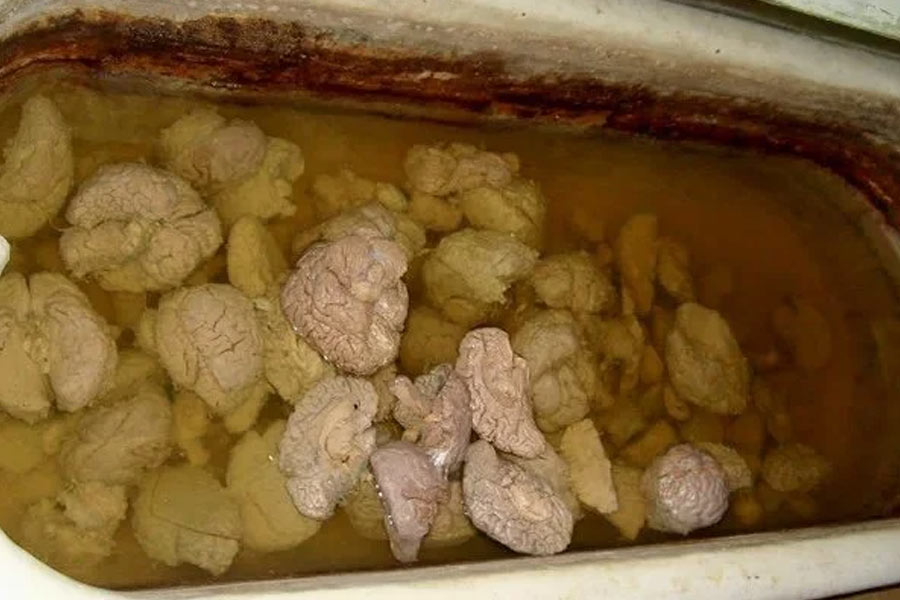 ডেনিশ অ্যাসোসিয়েশন ফর মেন্টাল হেল্‌থ-এর ডিরেক্টর নাড কার্স্টেনসেন বলেন, ‘‘এই বিপুল সংখ্যক মস্তিষ্ক নিয়ে কী করা হবে, সে বিষয়ে বহু আলোচনা হয়েছে। অনেকের দাবি, মস্তিষ্কগুলি হয় কবর দেওয়া হোক বা অন্য কোনও নৈতিক উপায়ে এই সংগ্রহকে নষ্ট করে দেওয়া হোক।’’