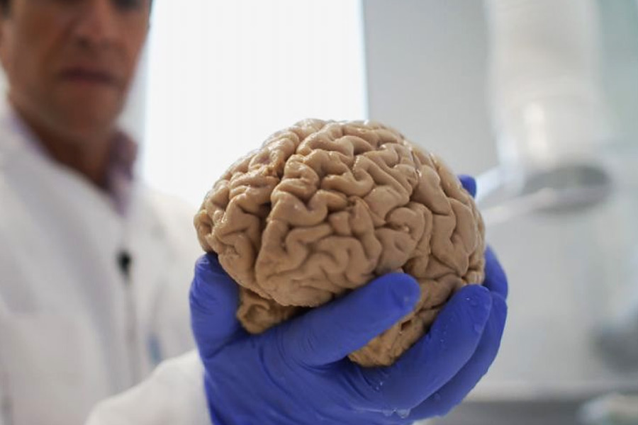 কার্স্টেনসেন আরও বলেন, ‘‘অনেকের দাবি, ইতিমধ্যেই বহু রোগীর ক্ষতি করা হয়ে গিয়েছে। ওই মস্তিষ্কগুলি যাতে গবেষণার কাজে লাগানো যেতে পারে, এ বার অন্তত তা দেখা উচিত!’’