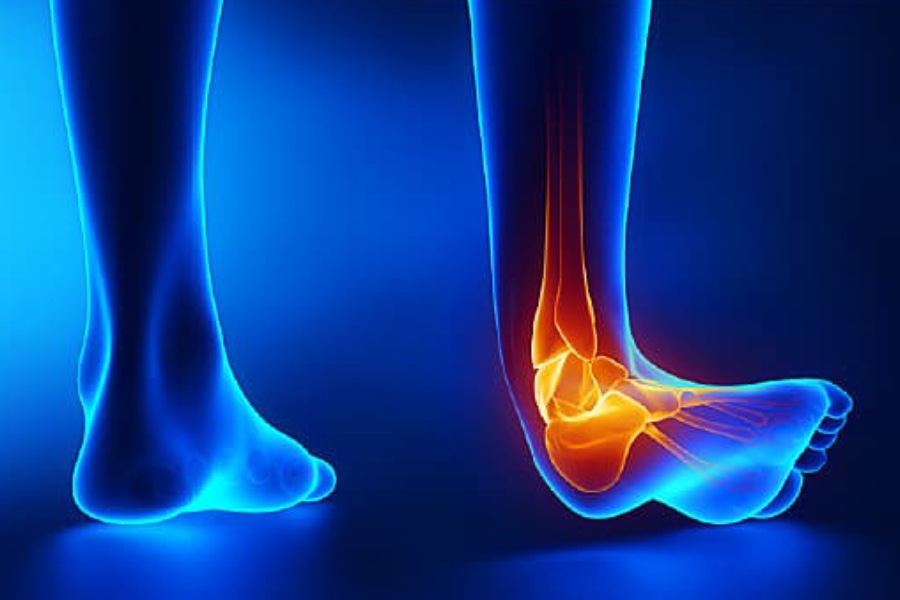 পায়ের পাতাও বেশি আক্রান্ত হয় এই রোগে। 