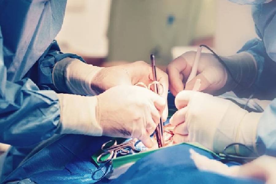 কিশোরীর পেটে এত পরিমাণে চুল জমে ছিল যে, খাবার ঢোকার বিন্দু মাত্র জায়গা ছিল না।