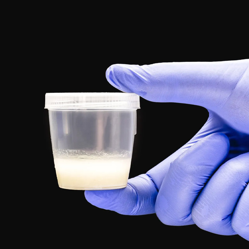 জেমসের বিরুদ্ধে অভিযোগ করেন এক মহিলাও। সারা (নাম পরিবর্তিত) জানান, জেমসের স্পার্ম ব্যবহার করেই তাঁর দুই সন্তানের জন্ম। তিনি এবং তাঁর সমকামী সঙ্গী দু’জনেই মা হওয়ার জন্য আগ্রহী ছিলেন।