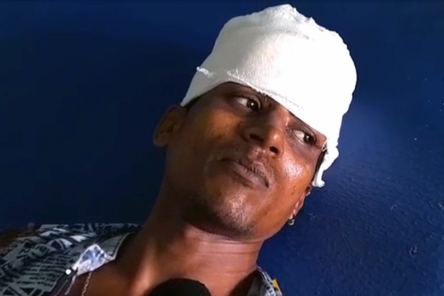 রামপুরহাট মেডিক্যাল কলেজের চিকিৎসকরা জানান, সজলের অবস্থা আশঙ্কাজনক। তাঁর শরীরের একাধিক জায়গায় গুরুতর আঘাত লেগেছে।