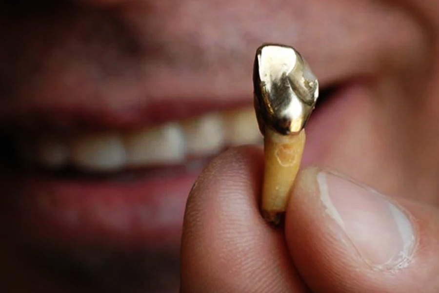 লুসি আরও জানিয়েছেন, এক-একটি খুনের পর নিজের সেই কীর্তি স্মরণীয় করে রাখতে একটি করে সোনার দাঁত সংগ্রহ করতেন ডোনাল্ড। সেগুলিই ছিল তাঁর ‘ট্রফি’ বা পুরস্কার।