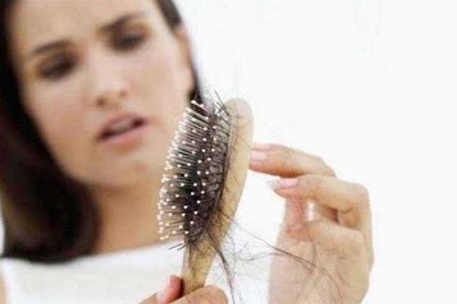 অতিরিক্ত চিনি শরীরে গেলে, তা চুল উঠে যাওয়ার একটি কারণ হতে পারে।