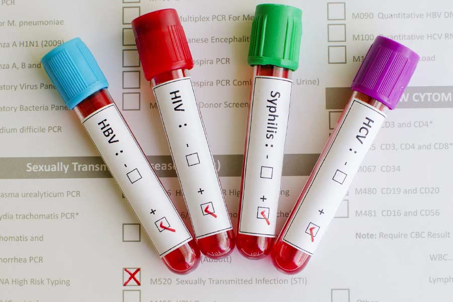 সমান্থার কথায়, নিয়মিত এত পরীক্ষা করানো হয় যে, যার ফলে পর্নশিল্পীদের যৌনরোগের ঝুঁকি কম থাকে। এমনকি, নীল ছবির সঙ্গে যুক্ত কোনও শিল্পী যদি বাইরের কারও সঙ্গে যৌনসম্পর্কে লিপ্ত হন এবং সেখান থেকে এসটিডিতে আক্রান্ত হন, তা হলেও পরীক্ষার পর রোগ সম্পর্কে অবগত হওয়া যায়। ফলে নীল ছবির দুনিয়ায় সহজেই বাসা বাঁধতে পারে না যৌনরোগ। 