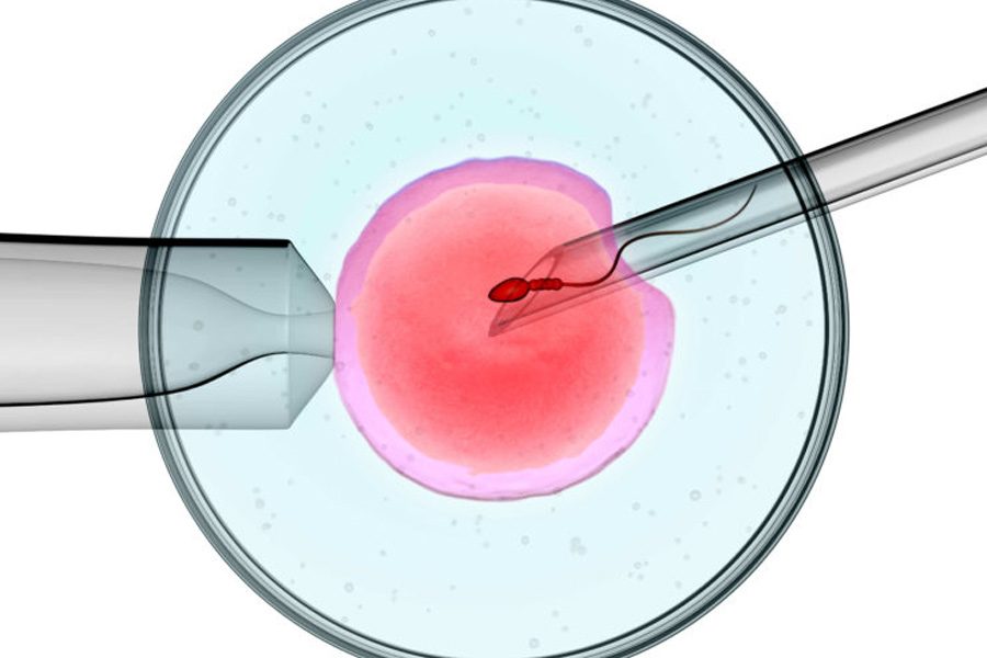 সব ঠিক থাকলে আগামী নভেম্বর বা ডিসেম্বর মাসেই মৃত স্বামীর সংরক্ষিত শুক্রাণু নিজের গর্ভে ধারণ করবেন ফ্যাবি পাওয়েল। 