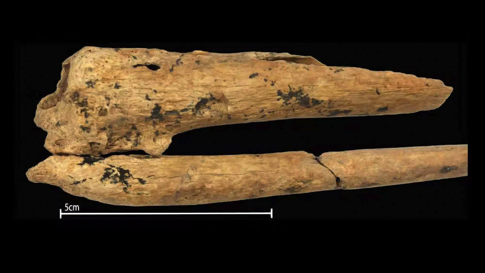 সংবাদমাধ্যমে দাবি করা হচ্ছে, এটাই প্রাগৈতিহাসিক অস্ত্রোপচারের প্রথম প্রমাণ। চিকিৎসা ব্যবস্থায় প্রাচীন মানুষ যে কতটা এগিয়ে ছিল, এই কঙ্কাল তার হদিস দিয়েছে। 