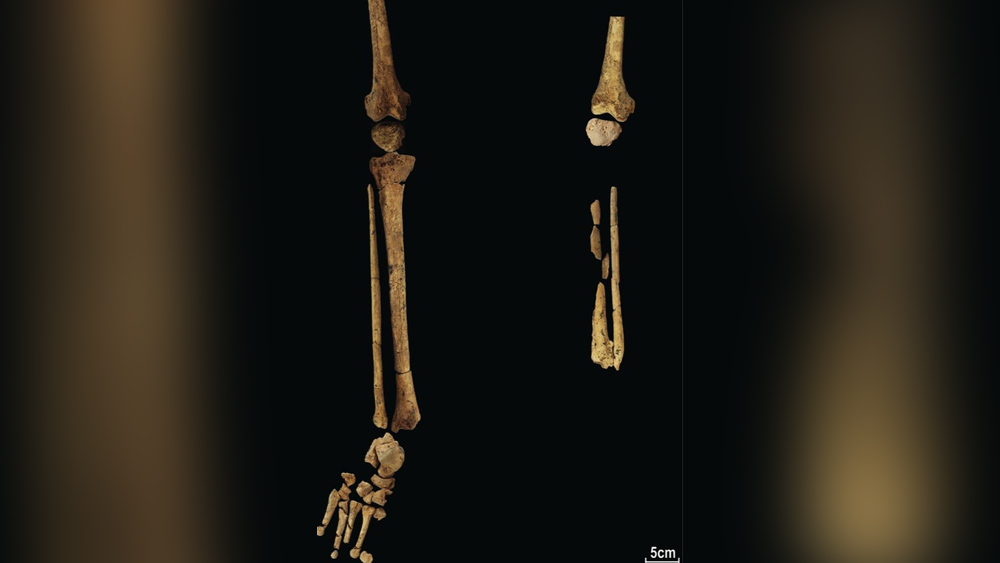 ‘নেচার’-এর প্রতিবেদনে বলা হয়েছে, এই আবিষ্কার প্রমাণ করে, প্রাগৈতিহাসিক যুগে এশিয়ার বিস্তীর্ণ অঞ্চলে চিকিৎসা পদ্ধতি অত্যন্ত উন্নত ছিল। প্রাচীন মানুষ অস্ত্রোপচারে সুদক্ষ ছিলেন।