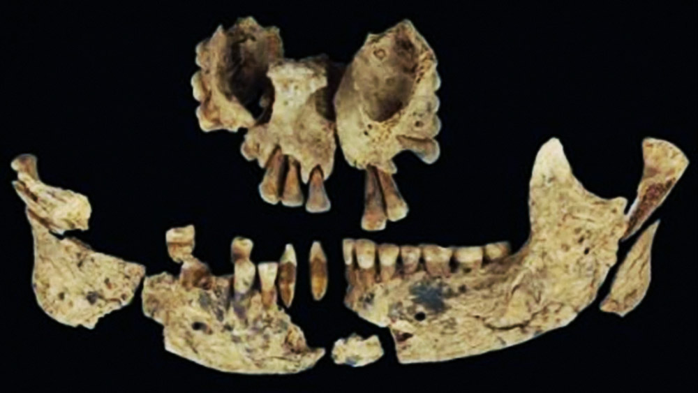 এর আগে প্রাচীনতম অঙ্গচ্ছেদ অস্ত্রোপচারের নিদর্শন ছিল ফ্রান্সে। সাত হাজার বছর আগে সেখানকার এক কৃষকের হাত কেটে বাদ দেওয়া হয়েছিল অস্ত্রোপচারের মাধ্যমে।