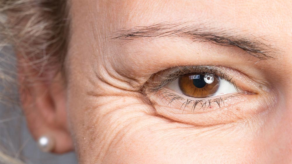 মুখের চামড়া যেন কুঁচকে না যায়, সেই কারণে নামী ব্র্যান্ডের বহু দামি প্রসাধনী ব্যবহার করা হয়। কিন্তু এর বদলে ব্যবহার করা যায় ফটকিরিও।