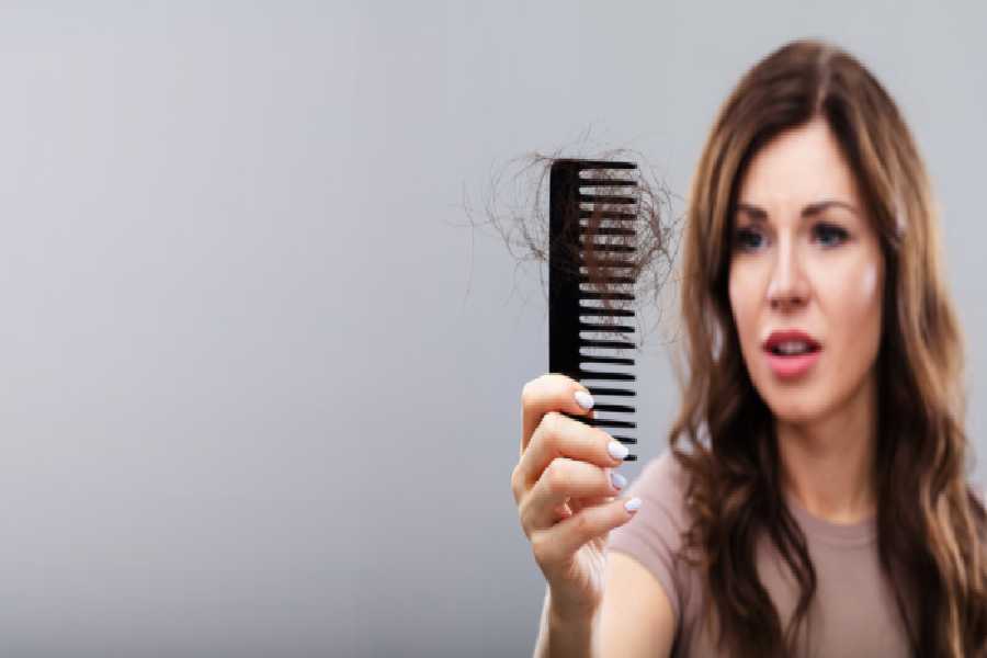 চুল পড়া আটকানো সহজ নয়।