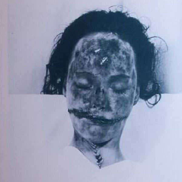 এলিজাবেথের ঠোঁটের দু’দিকের ধার থেকে দুই কান পর্যন্ত এমন ভাবে কেটে দেওয়া হয়েছিল, যা দেখে মনে হচ্ছিল মৃত্যুর পরেও তিনি হাসছেন। আকর্ণ সেই হাসি স্থায়ী হয়েছিল তরুণীর মুখে। ইংরেজিতে একে বলা হয় ‘গ্লাসগো স্মাইল’।