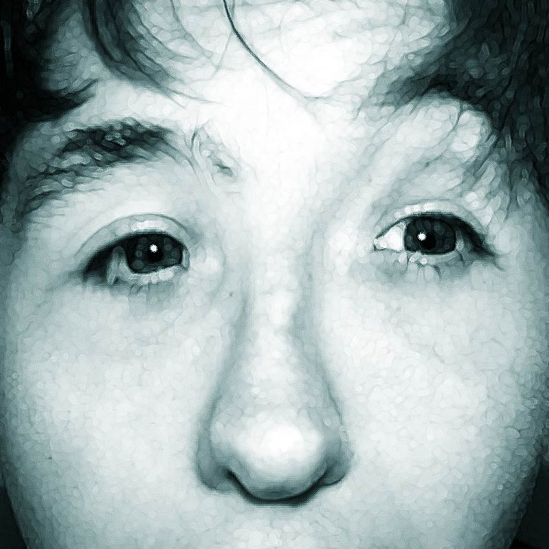 ডুয়ান সিনড্রোমের কারণে জোশুহার চোখের পেশিগুলি সঠিক ভাবে বিকশিত হয়নি। এই রোগের কারণে চোখের মণি ঘোরাতেও অসুবিধা হত তাঁর।