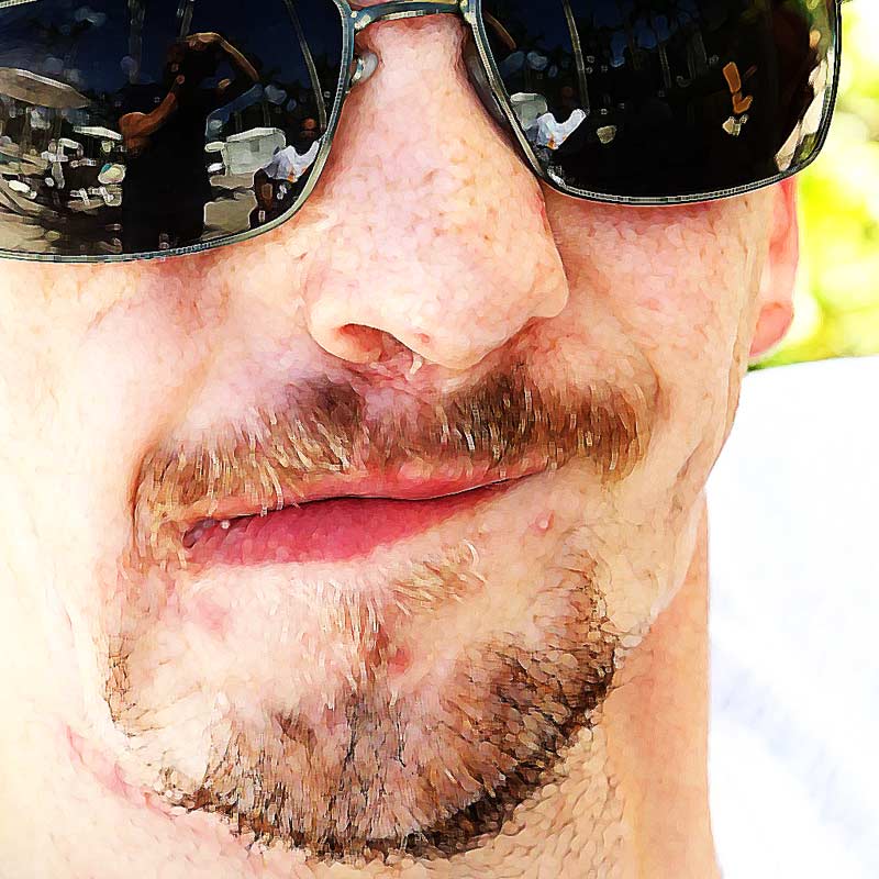 গোল্ডেনহার সিন্ড্রোমের কারণে জোশুহার মুখ ও মাথার হাড়ের গঠনও স্বাভাবিক ছিল না। মেরুদণ্ড-সহ আরও বিভিন্ন অঙ্গের সমস্যাও ছিল তাঁর।