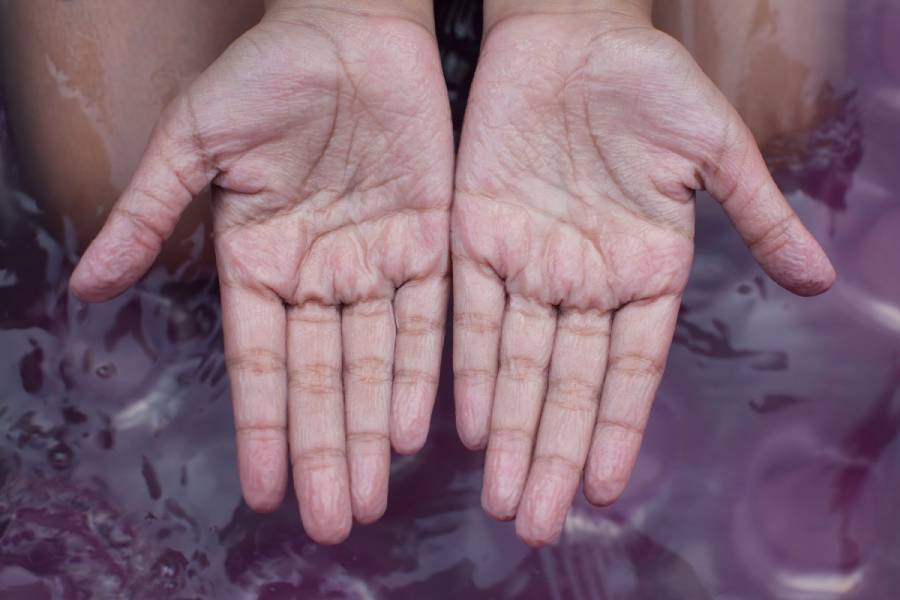  Image of Wrinkle Hand.