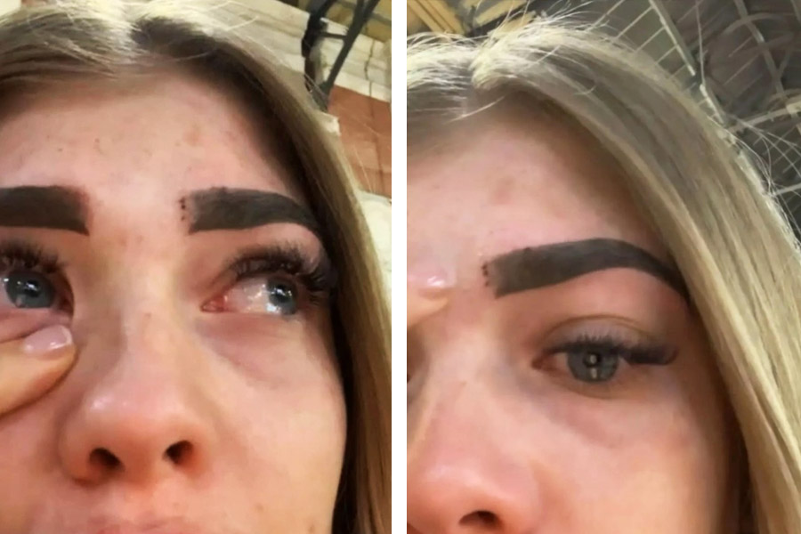 A young woman has been left with permanently mangled eyebrows after getting free micro blading 