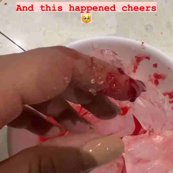 Mimi Accidentallu cuts her own hand