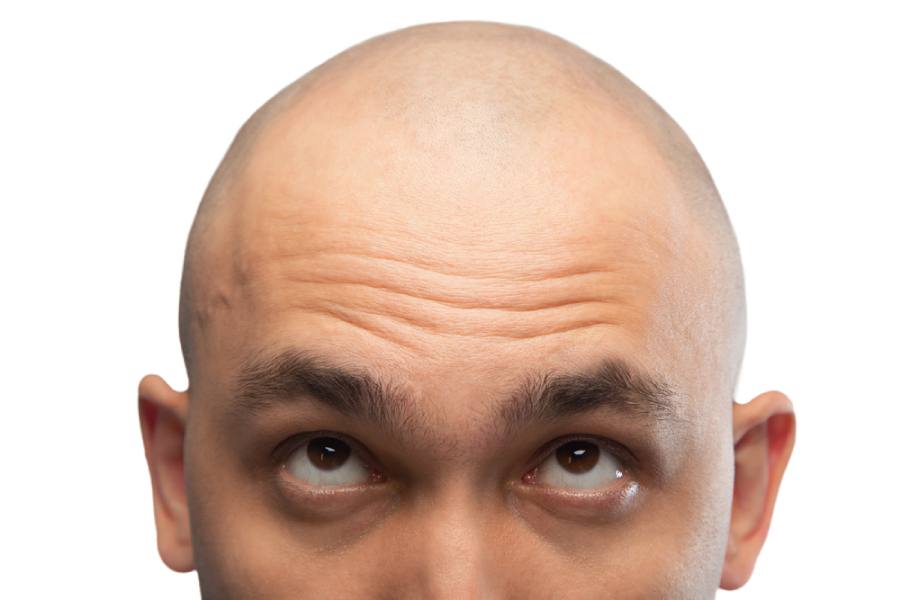 take care for a shaved head during summer