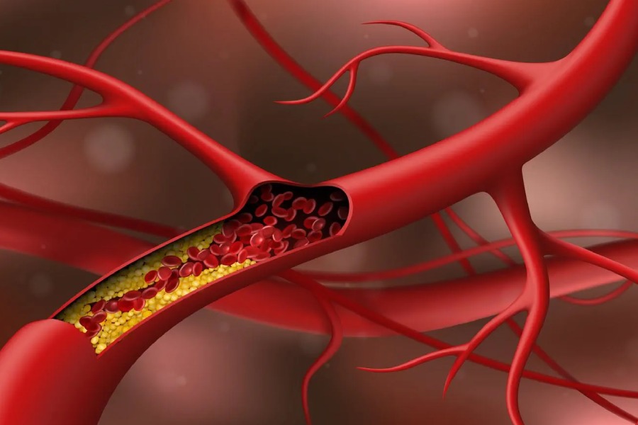 symbolic image of Cholesterol