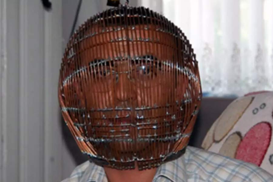 Man caged his head