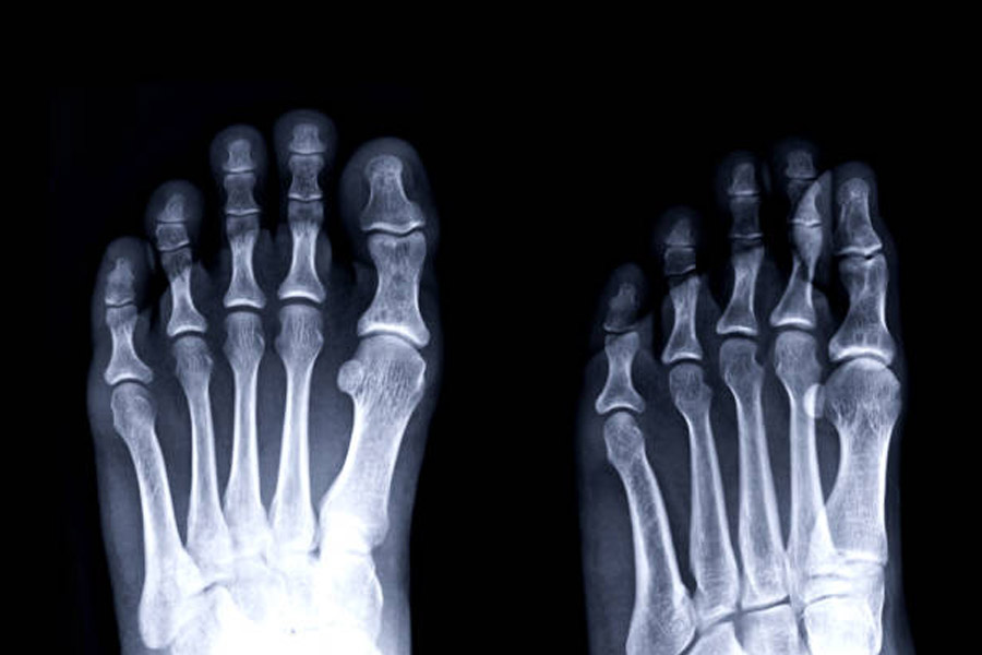 Pet dog chews toe of old man turns out to be live saver.