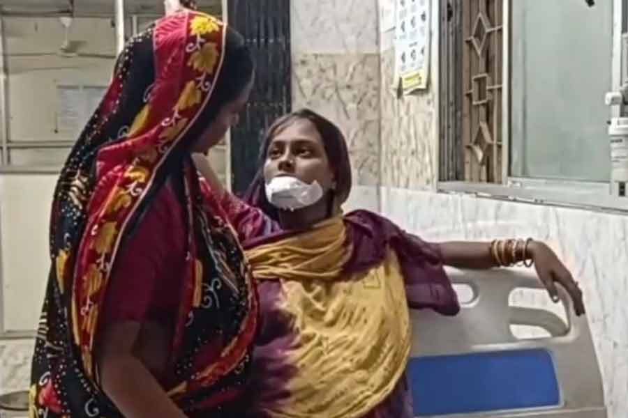 Husband allegedly chews off Wife’s lips in South 24 Pargana’s Basanti