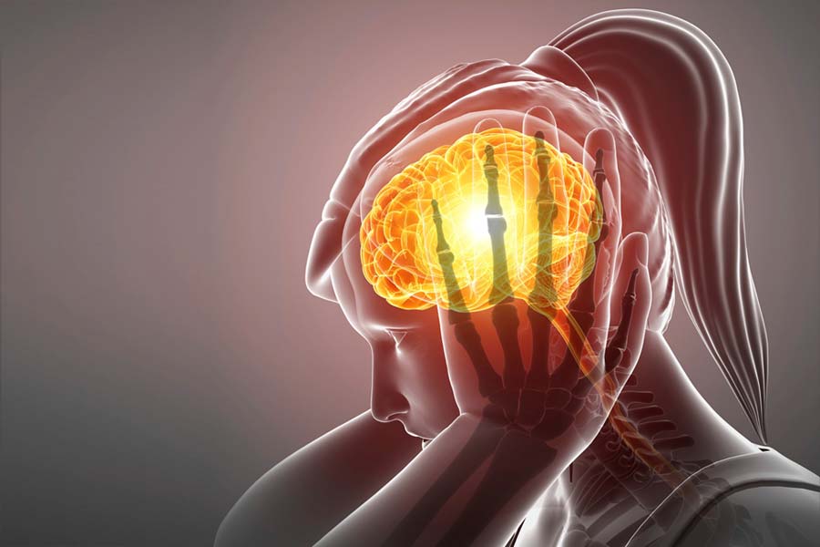 Image of migraine.