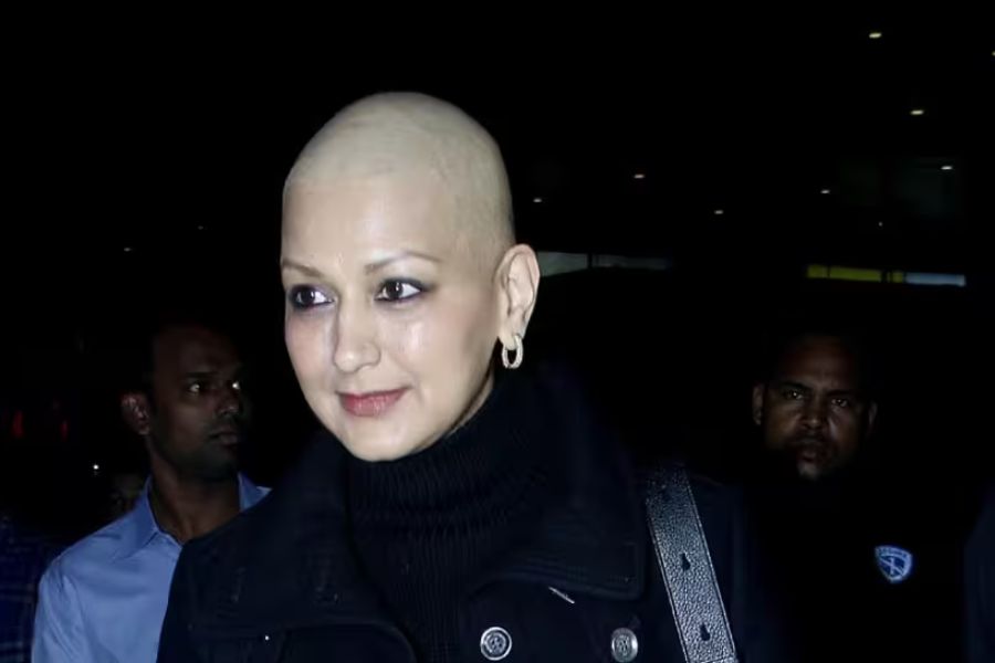 টাক মাথায় সোনালি বেন্দ্রে