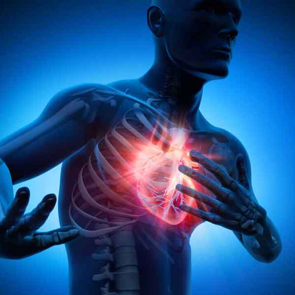 photo of Heart Attack 