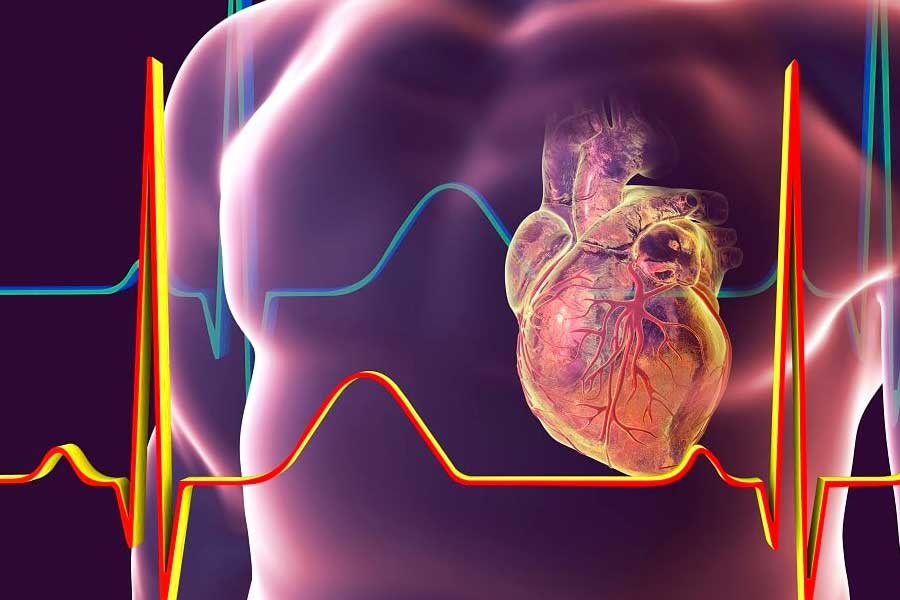 photo of Heart Attack 