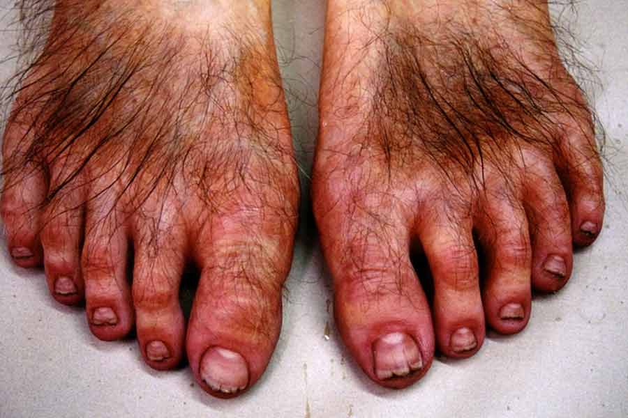 উজ্জ্বল রঙের পোশাক পরতে ভালবাসে। পছন্দের রং হলুদ কিংবা সবুজ। তবে পোশাক যা-ই হোক, তার সঙ্গে শীত-গ্রীষ্ম-বর্ষা সারা বছরই থাকে গরম ওয়েস্টকোট। আর খুব সেজেগুজেও এরা থাকে খালি পায়ে।