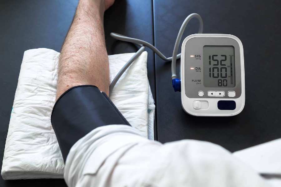 Five alarming signs of high blood pressure you should not ignore.