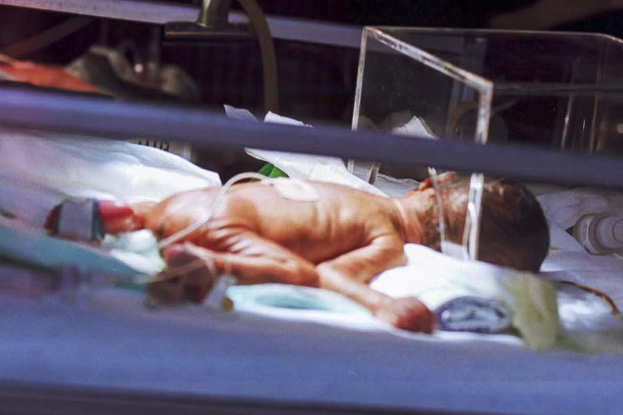 স্থানীয় স্বাস্থ্য প্রশাসন সূত্রে খবর, ফুসফুসের এই রহস্যজনক রোগের নাম ‘হোয়াইট লাং সিনড্রোম’। চিনের পর আমেরিকায় রোগটির প্রাদুর্ভাব চিন্তায় ফেলেছে প্রশাসনকে। অনবরত বৃদ্ধি পেয়ে চলেছে আক্রান্তের সংখ্যা।